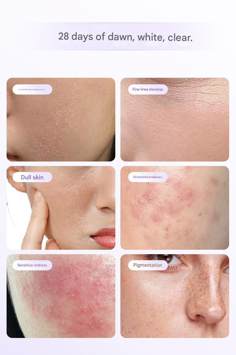 红光美容仪（面部） - 8